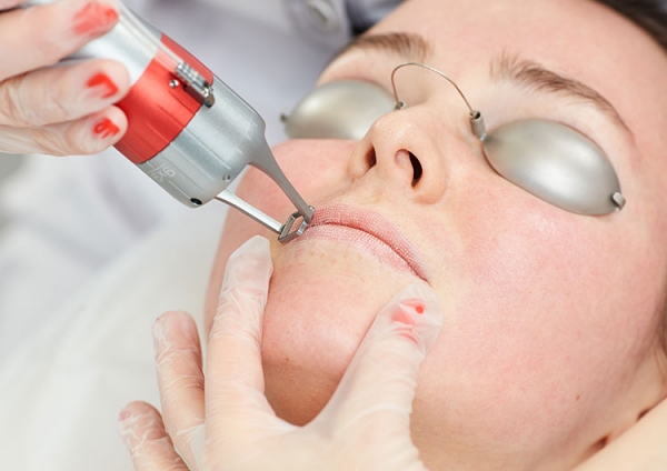 Процедура недели: пилинг Shining Peel и лазерное омоложение губ